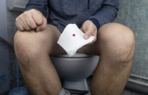 Blødning fra endetarmen